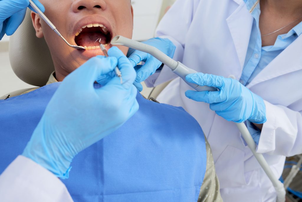 paciente masculino recortado boca abierta examen dientes odontologia 1